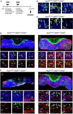 The Stem Cell Connection of Pituitary Tumors